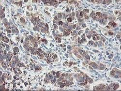 RPN1 Monoclonal Antibody (OTI2E3), TrueMAB , OriGene 100 &mu;L; Unconjugated:Antibodies,