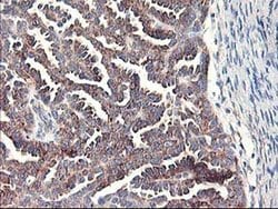 RPN1 Monoclonal Antibody (OTI2E3), TrueMAB , OriGene 100 &mu;L; Unconjugated:Antibodies,