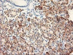 RPN1 Monoclonal Antibody (OTI2E3), TrueMAB , OriGene 100 &mu;L; Unconjugated:Antibodies,