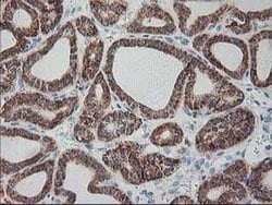 RPN1 Monoclonal Antibody (OTI2E3), TrueMAB , OriGene 100 &mu;L; Unconjugated:Antibodies,