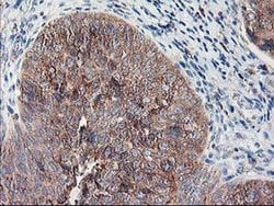 RPN1 Monoclonal Antibody (OTI2E3), TrueMAB , OriGene 100 &mu;L; Unconjugated:Antibodies,