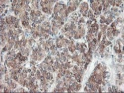 RPN1 Monoclonal Antibody (OTI2E3), TrueMAB , OriGene 100 &mu;L; Unconjugated:Antibodies,