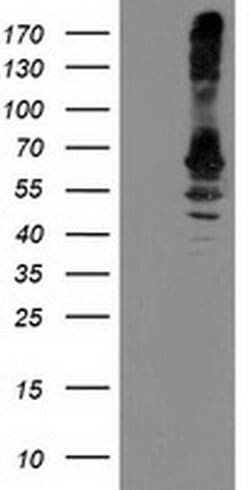 RPN1 Monoclonal Antibody (OTI6F2), TrueMAB , OriGene 100 &mu;L | Buy Online | Origene Technologies | Fisher Scientific