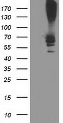 RPN1 Monoclonal Antibody (OTI3H3), TrueMAB , OriGene 30 &mu;L; Unconjugated:Antibodies,