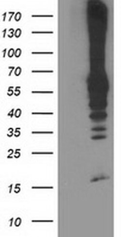 RPN1 Monoclonal Antibody (OTI5A1), TrueMAB , OriGene 100 &mu;L; Unconjugated:Antibodies,