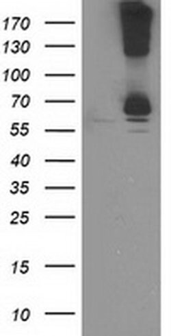 RPN1 Monoclonal Antibody (OTI6A9), TrueMAB , OriGene 100 &mu;L; Unconjugated:Antibodies,