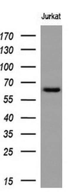 RPN1 Monoclonal Antibody (OTI2G9), TrueMAB , OriGene 30 &mu;L; Unconjugated:Antibodies,