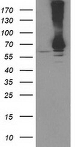 RPN1 Monoclonal Antibody (OTI2G1), TrueMAB , OriGene 30 &mu;L; Unconjugated:Antibodies,