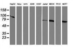 RPN1 Monoclonal Antibody (OTI2G1), TrueMAB , OriGene:Antibodies:Primary
