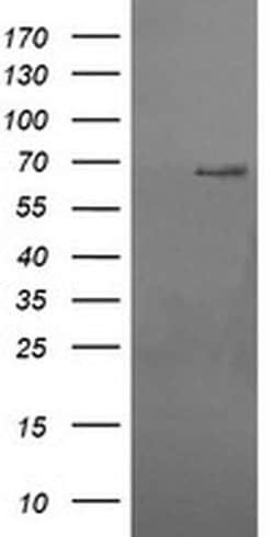 RPN1 Monoclonal Antibody (OTI5B1), TrueMAB , OriGene 100 &mu;L; Unconjugated:Antibodies,
