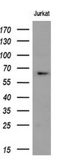 RPN1 Monoclonal Antibody (OTI5B1), TrueMAB , OriGene 100 &mu;L; Unconjugated:Antibodies,