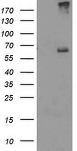 RPN1 Monoclonal Antibody (OTI2E3), TrueMAB , OriGene 100 &mu;L; Unconjugated:Antibodies,
