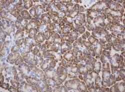 RPN2 Mouse anti-Human, Clone: OTI1G9, lyophilized, TrueMAB 100 &mu;g; Unconjugated:Antibodies,