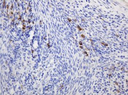 RPN2 Mouse anti-Human, Clone: OTI1G9, lyophilized, TrueMAB 100 &mu;g; Unconjugated:Antibodies,