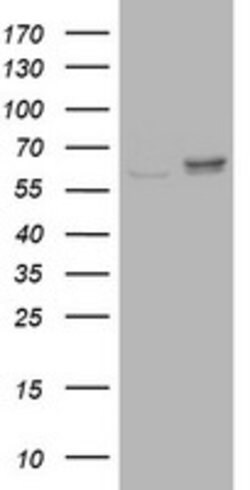 RPN2 Mouse anti-Human, Clone: OTI1G9, lyophilized, TrueMAB 100 &mu;g; Unconjugated:Antibodies,