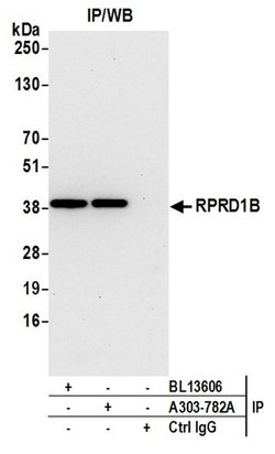 RPRD1B Rabbit anti-Human, Mouse, Polyclonal, Bethyl Laboratories 100 &mu;L;