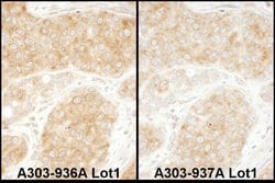 RPS11 Rabbit anti-Human, Mouse, Polyclonal, Bethyl Laboratories 100 &mu;L;