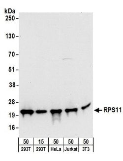 RPS11 Rabbit anti-Human, Mouse, Polyclonal, Bethyl Laboratories 100 &mu;L;