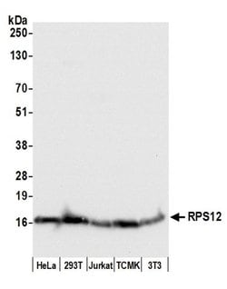 RPS12/Ribosomal Protein S12 Polyclonal Antibody, Bethyl Laboratories 20 &mu;L | Buy Online | Bethyl Laboratories, Inc | Fisher Scientific