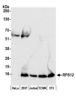 RPS12/Ribosomal Protein S12 Polyclonal Antibody, Bethyl Laboratories:Antibodies:Primary