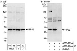 RPS2 Rabbit anti-Human, Polyclonal, Bethyl Laboratories 100 &mu;L; Unconjugated:Antibodies,