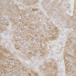 Ribosomal Protein S3A/RPS3A Rabbit anti-Human, Mouse, Polyclonal, Bethyl