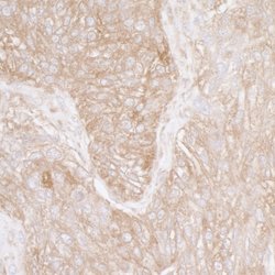 Ribosomal Protein S3A/RPS3A Rabbit anti-Human, Mouse, Polyclonal, Bethyl Laboratories 100 &mu;L | Buy Online | Bethyl Laboratories, Inc | Fisher Scientific