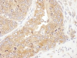 RPS5 Rabbit anti-Human, Mouse, Polyclonal, Bethyl Laboratories 100 &mu;L;