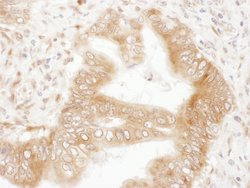 RPS5 Rabbit anti-Human, Mouse, Polyclonal, Bethyl Laboratories 100 &mu;L;