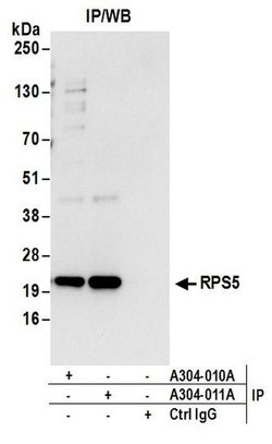 RPS5 Rabbit anti-Human, Mouse, Polyclonal, Bethyl Laboratories 100 &mu;L;