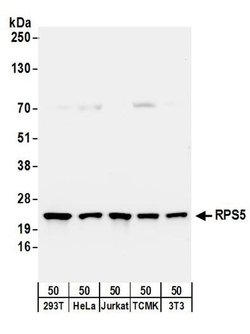 RPS5 Rabbit anti-Human, Mouse, Polyclonal, Bethyl Laboratories 100 &mu;L;