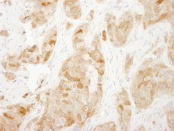 RPS6 Polyclonal Antibody, Bethyl Laboratories 10 &mu;L; Unconjugated:Antibodies,