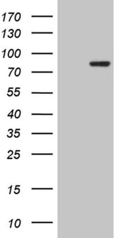 RPS6KA2 Monoclonal Antibody (OTI2H10), TrueMAB , OriGene 100 &mu;L; Unconjugated:Antibodies,