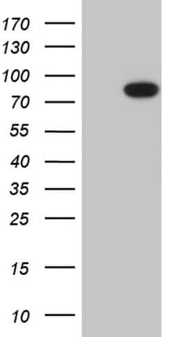 RPS6KA2 Monoclonal Antibody (OTI10F11), TrueMAB , OriGene 100 &mu;L; Unconjugated:Antibodies,