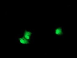 RPS6KB1 Mouse anti-Canine, Human, Mouse, Clone: OTI6B2, lyophilized, TrueMAB