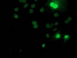 RPS6KB1 Monoclonal Antibody (OTI4G4), TrueMAB , OriGene 100 &mu;L; Unconjugated:Antibodies,