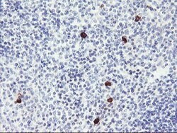 RPS6KB1 Mouse anti-Canine, Human, Mouse, Clone: OTI6B2, lyophilized, TrueMAB