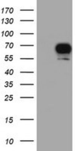 RPS6KB1 Mouse anti-Canine, Human, Mouse, Clone: OTI6B2, lyophilized, TrueMAB