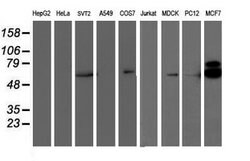 RPS6KB1 Mouse anti-Canine, Human, Mouse, Clone: OTI6B2, lyophilized, TrueMAB