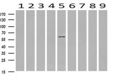 RPS6KB1 Mouse anti-Canine, Human, Mouse, Clone: OTI6B2, lyophilized, TrueMAB