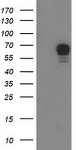 RPS6KB1 Monoclonal Antibody (OTI4G4), TrueMAB , OriGene:Antibodies:Primary