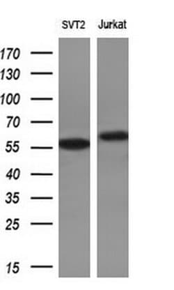 RPS6KB1 Monoclonal Antibody (OTI4G4), TrueMAB , OriGene:Antibodies:Primary