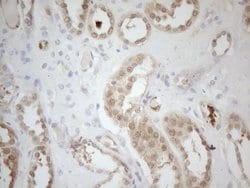 RPS6KC1 Monoclonal Antibody (OTI10F11), TrueMAB , OriGene 100 &mu;L; Unconjugated:Antibodies,