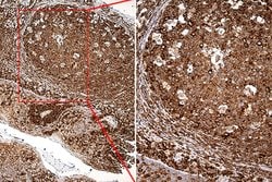 RPSA Monoclonal Antibody (OTI1G3), TrueMAB , OriGene 100 &mu;L; Unconjugated:Antibodies,