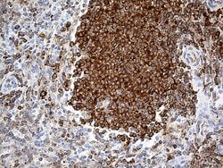 RPSA Monoclonal Antibody (OTI1G3), TrueMAB , OriGene 100 &mu;L; Unconjugated:Antibodies,
