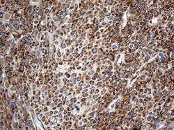 RPSA Monoclonal Antibody (OTI1G3), TrueMAB , OriGene 100 &mu;L; Unconjugated:Antibodies,