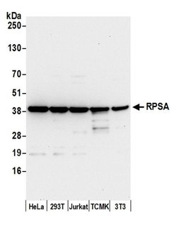 RPSA Polyclonal Antibody, Bethyl Laboratories:Antibodies:Primary Antibodies