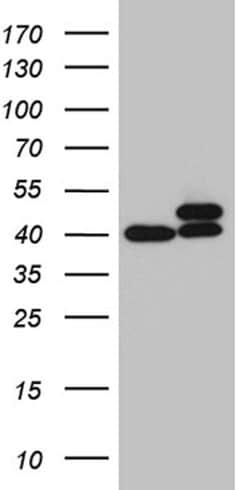 RPSA Monoclonal Antibody (OTI1G3), TrueMAB , OriGene 100 &mu;L; Unconjugated:Antibodies,