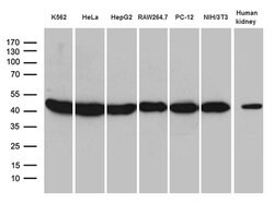RPSA Monoclonal Antibody (OTI1G3), TrueMAB , OriGene 100 &mu;L; Unconjugated:Antibodies,