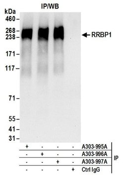 RRBP1 Rabbit anti-Human, Polyclonal, Bethyl Laboratories 100 &mu;L; Unconjugated:Antibodies,